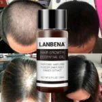 سرم رشد مو Lanbena - Image 3